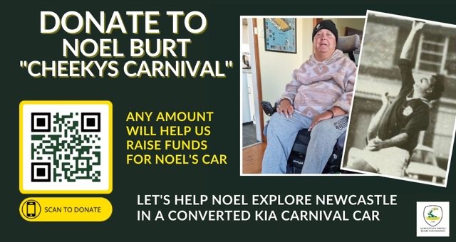 DONATE TO NOEL BURT “CHEEKYS CARNIVAL”